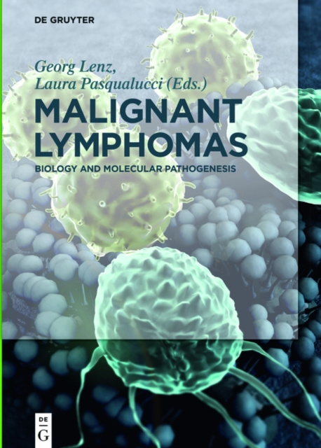 E-kniha Malignant Lymphomas Georg Lenz