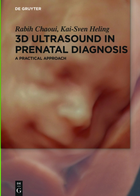 E-kniha 3D Ultrasound in Prenatal Diagnosis Rabih Chaoui