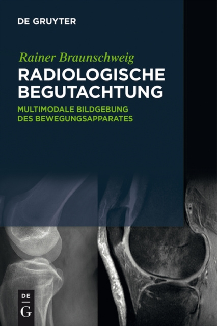 E-kniha Radiologische Begutachtung Rainer Braunschweig