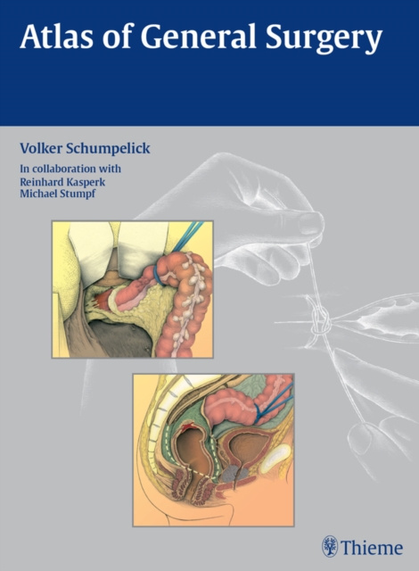 E-kniha Atlas of General Surgery Volker Schumpelick