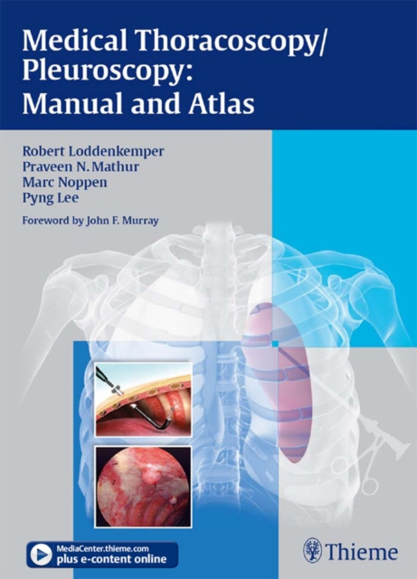 E-kniha Medical Thoracoscopy/Pleuroscopy: Manual and Atlas Robert Loddenkemper