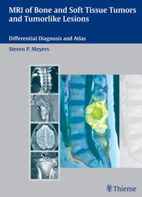 E-kniha MRI of Bone and Soft Tissue Tumors and Tumorlike Lesions Steven P. Meyers