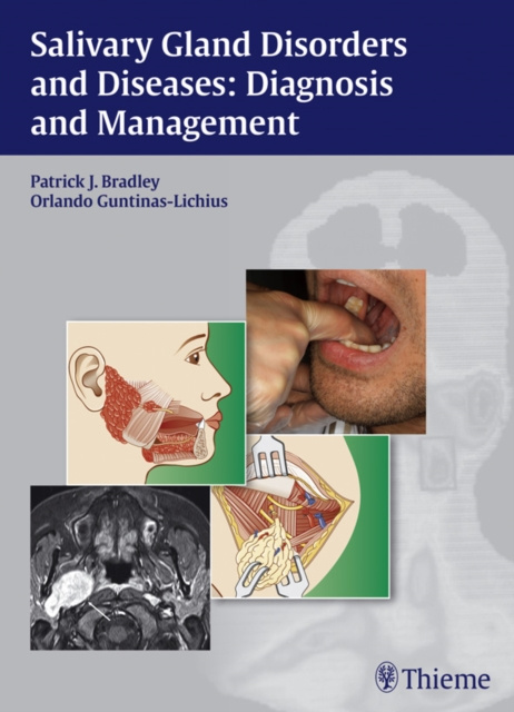 E-kniha Salivary Gland Disorders and Diseases: Diagnosis and Management Patrick J. Bradley