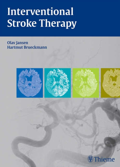 E-kniha Interventional Stroke Therapy Olav Jansen