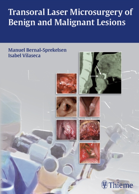 E-kniha Transoral Laser Microsurgery of Benign and Malignant Lesions Manuel Bernal-Sprekelsen