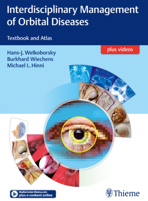 E-kniha Interdisciplinary Management of Orbital Diseases Hans-J. Welkoborsky