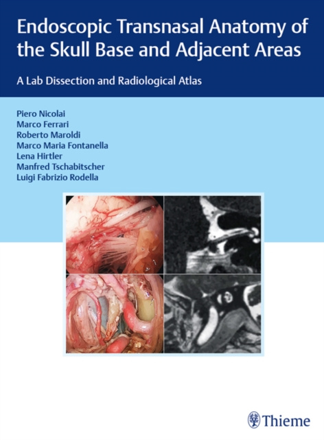 E-kniha Endoscopic Transnasal Anatomy of the Skull Base and Adjacent Areas Piero Nicolai