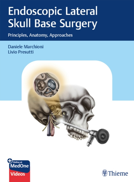 E-kniha Endoscopic Lateral Skull Base Surgery Daniele Marchioni
