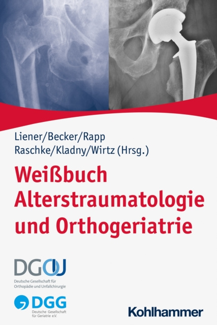 E-kniha Weibuch Alterstraumatologie und Orthogeriatrie Ulrich C. Liener