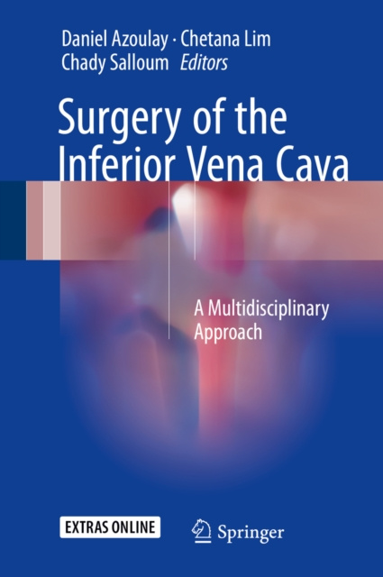 E-knjiga Surgery of the Inferior Vena Cava Daniel Azoulay