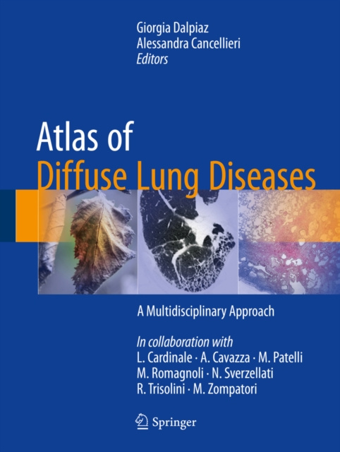 E-kniha Atlas of Diffuse Lung Diseases Giorgia Dalpiaz