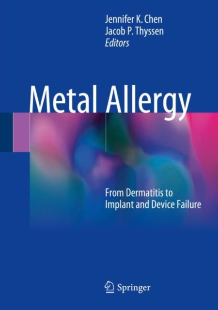 E-book Metal Allergy Jennifer K Chen