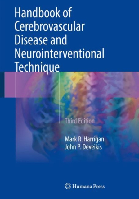 E-kniha Handbook of Cerebrovascular Disease and Neurointerventional Technique Mark R. Harrigan