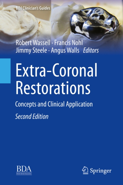 E-book Extra-Coronal Restorations Robert Wassell