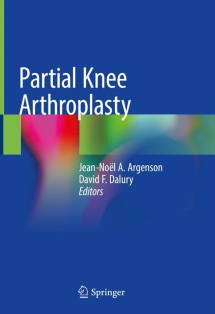 E-kniha Partial Knee Arthroplasty Jean-Noel A. Argenson