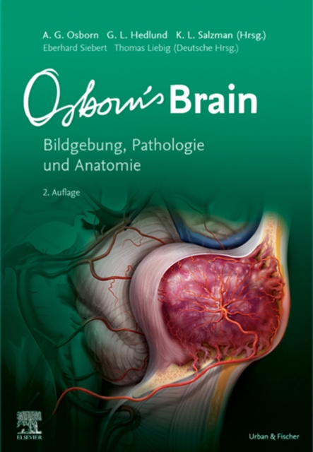 E-kniha Osborn's Brain Anne G. Osborn