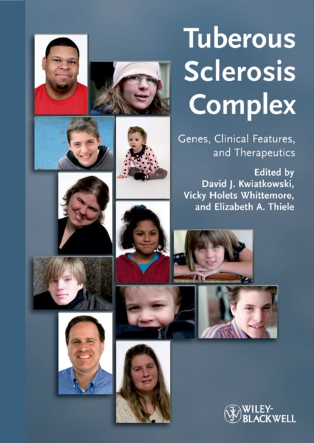 E-knjiga Tuberous Sclerosis Complex David J. Kwiatkowski