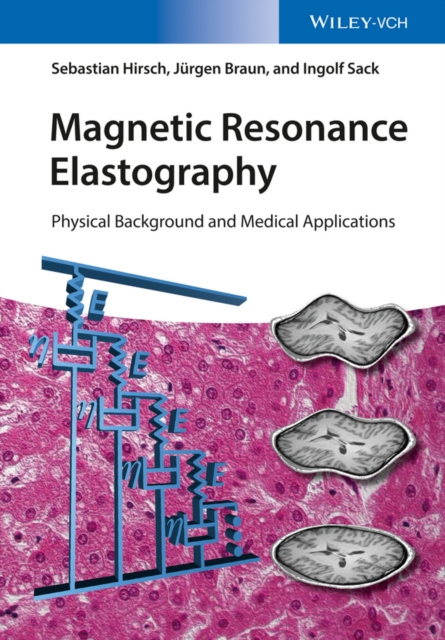 ebook Magnetic Resonance Elastography Sebastian Hirsch