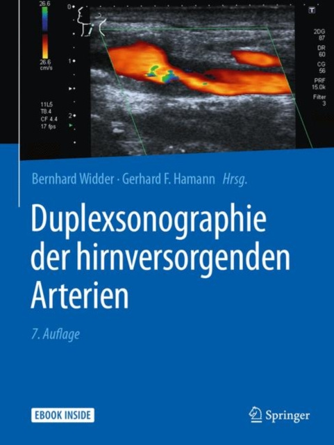 E-kniha Duplexsonographie der hirnversorgenden Arterien Bernhard Widder