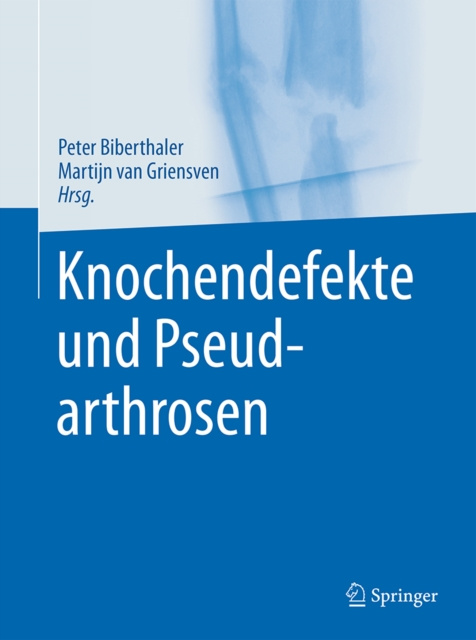 E-kniha Knochendefekte und Pseudarthrosen Peter Biberthaler