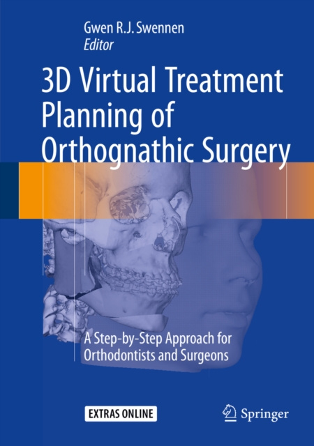 Libro elettronico 3D Virtual Treatment Planning of Orthognathic Surgery Gwen Swennen