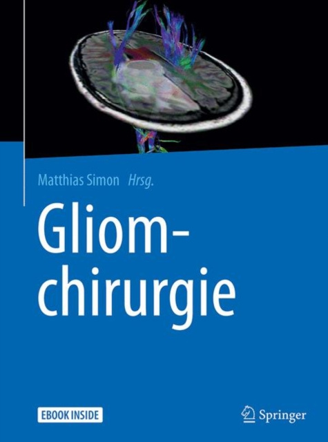 E-kniha Gliomchirurgie Matthias Simon