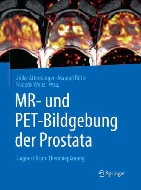 E-kniha MR- und PET-Bildgebung der Prostata Ulrike Attenberger