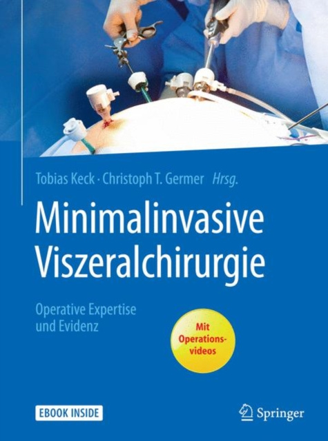 E-kniha Minimalinvasive Viszeralchirurgie Tobias Keck
