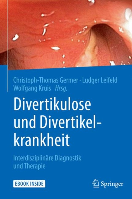 E-kniha Divertikulose und Divertikelkrankheit Christoph-Thomas Germer