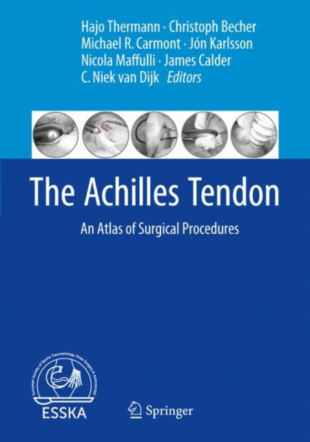 E-book Achilles Tendon Hajo Thermann