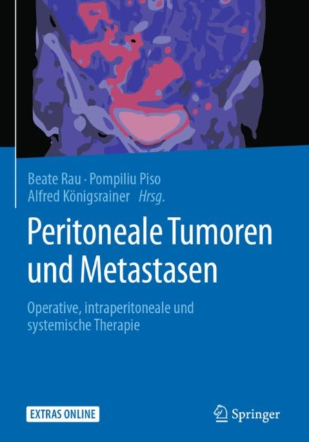 E-kniha Peritoneale Tumoren und Metastasen Beate Rau