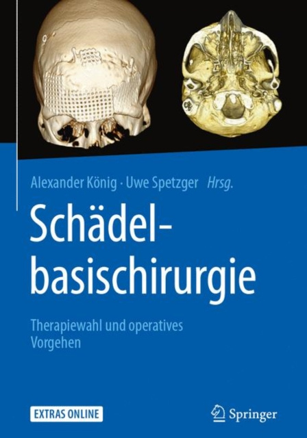 E-kniha Schadelbasischirurgie Alexander Konig