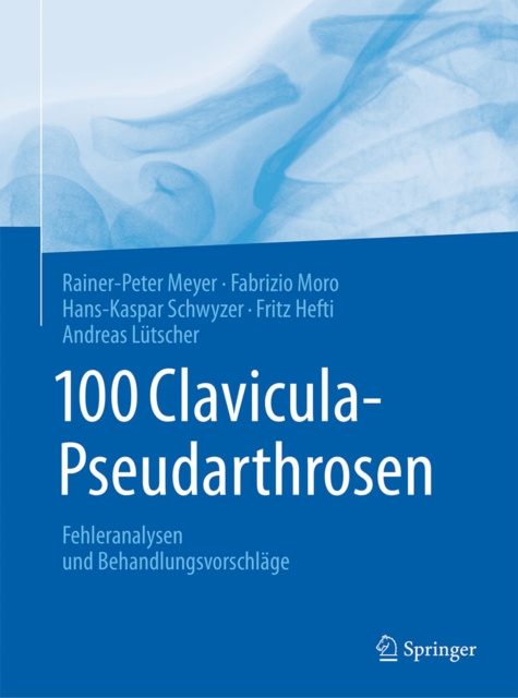 ebook 100 Clavicula-Pseudarthrosen Rainer-Peter Meyer