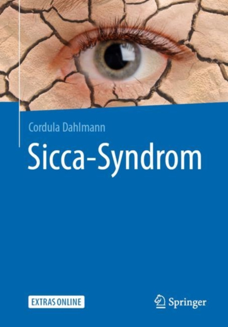E-kniha Sicca-Syndrom Cordula Dahlmann