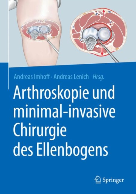 E-kniha Arthroskopie und minimal-invasive Chirurgie des Ellenbogens Andreas B. Imhoff