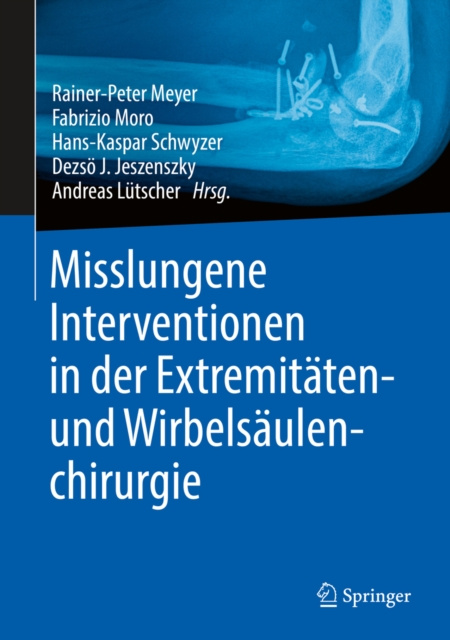 E-kniha Misslungene Interventionen in der Extremitaten- und Wirbelsaulenchirurgie Rainer-Peter Meyer