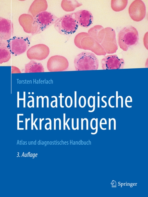 E-kniha Hamatologische Erkrankungen Torsten Haferlach