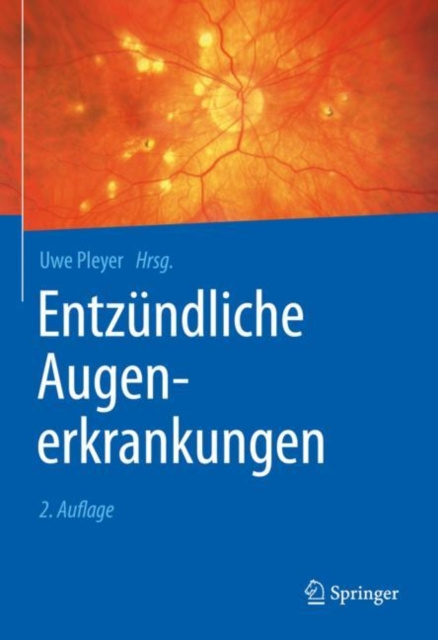 E-kniha Entzundliche Augenerkrankungen Uwe Pleyer