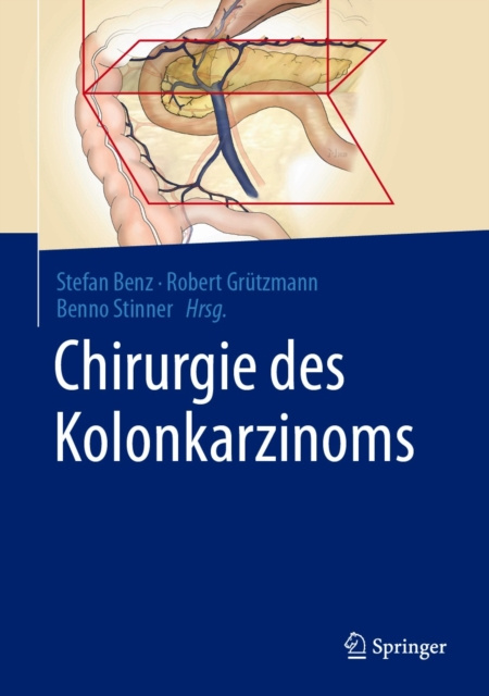 E-kniha Chirurgie des Kolonkarzinoms Stefan Benz