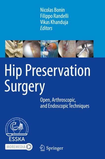 E-kniha Hip Preservation Surgery Nicolas Bonin