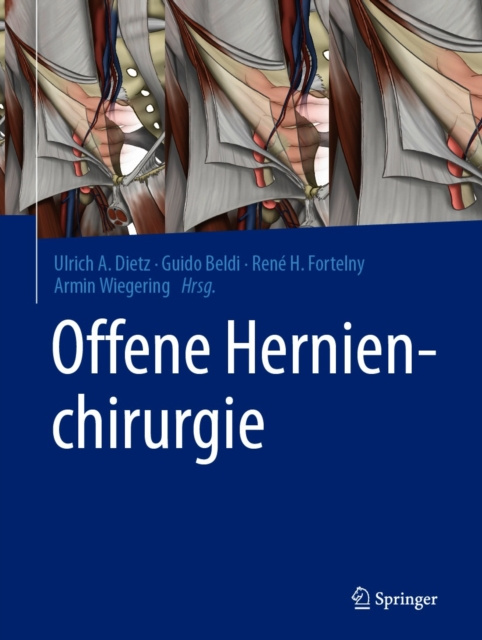 E-Book Offene Hernienchirurgie Ulrich A. Dietz
