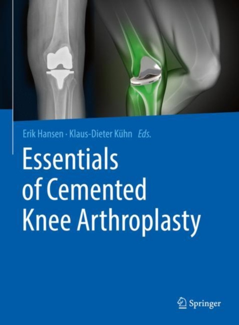E-book Essentials of Cemented Knee Arthroplasty Erik Hansen