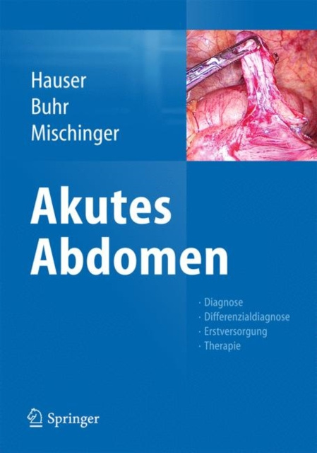 E-Book Akutes Abdomen Hubert Hauser
