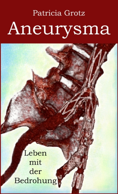E-knjiga Aneurysma Patricia Grotz