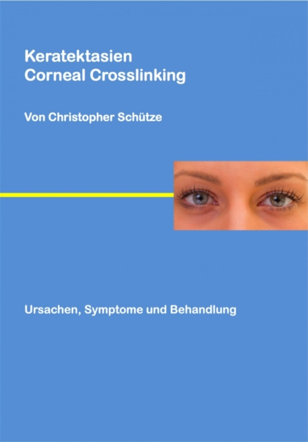 E-kniha Keratektasien Christopher Schutze