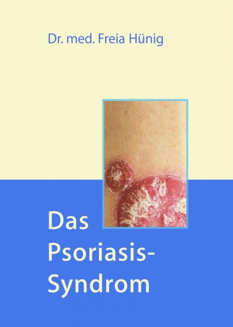 E-book Das Psoriasis-Syndrom Dr. Freia Hunig