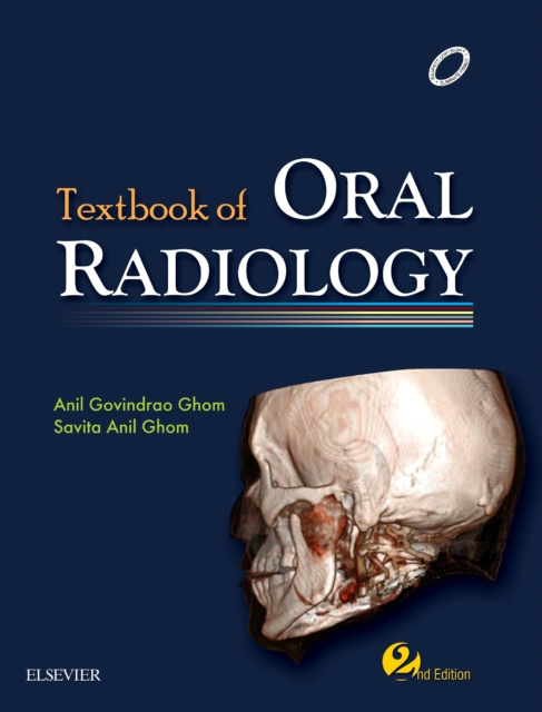 E-kniha Textbook of Oral Radiology - E-Book Anil Govindrao Ghom