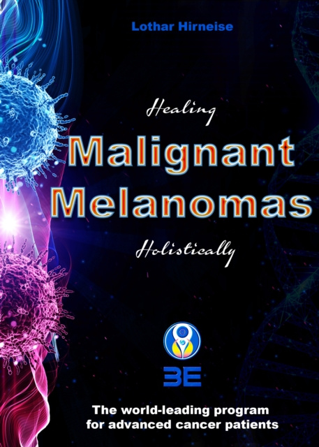 E-book Malignant Melanomas Lothar Hirneise