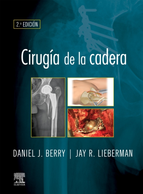 E-kniha Cirugia de la cadera Daniel J. Berry