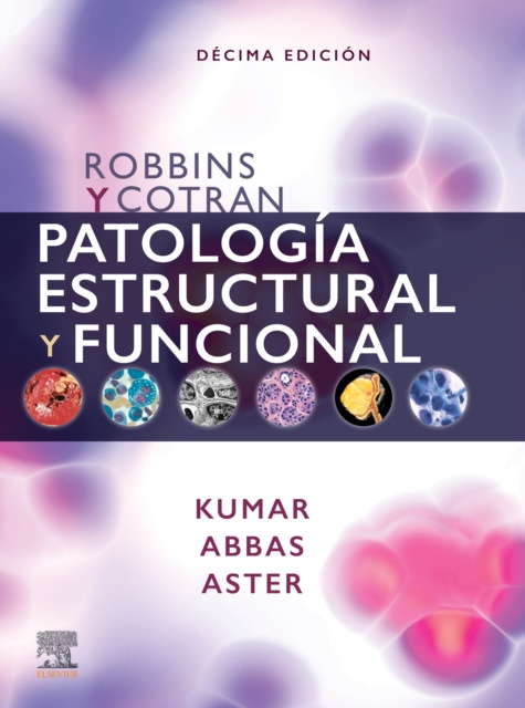 E-kniha Robbins y Cotran. Patologia estructural y funcional Vinay Kumar